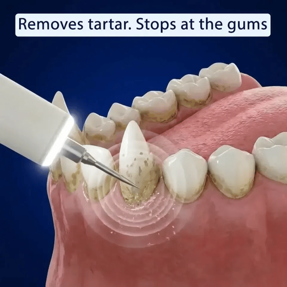 RodentLab ultrasonic dog tartar remover product image 2